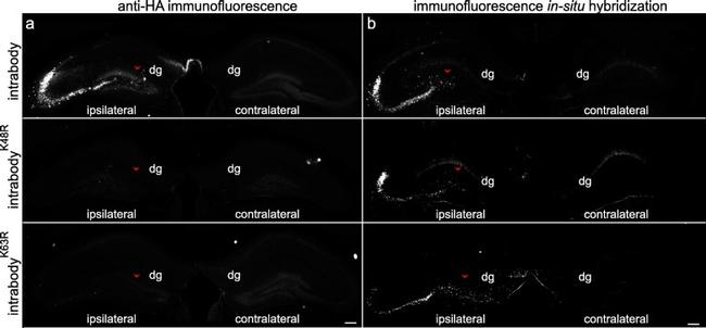 Tau Antibody in Immunocytochemistry, Immunohistochemistry (ICC/IF, IHC)