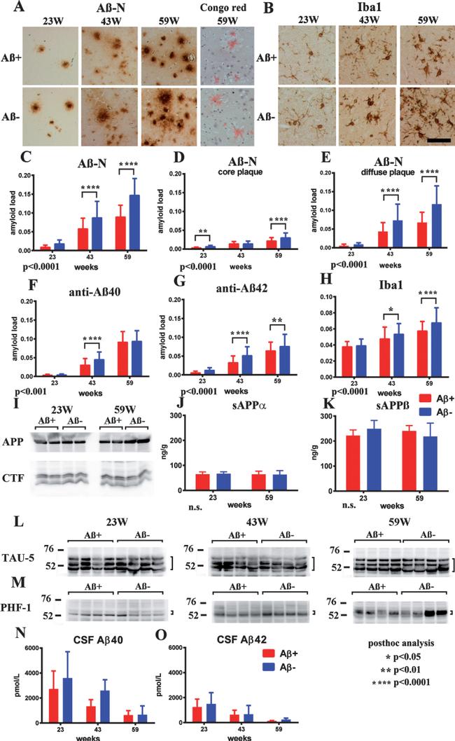 beta Amyloid (1-42) Antibody in Western Blot (WB)