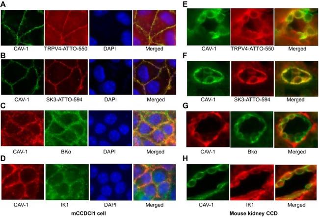 Caveolin 1 Antibody in Immunocytochemistry (ICC/IF)