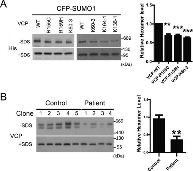 VCP Antibody in Western Blot (WB)