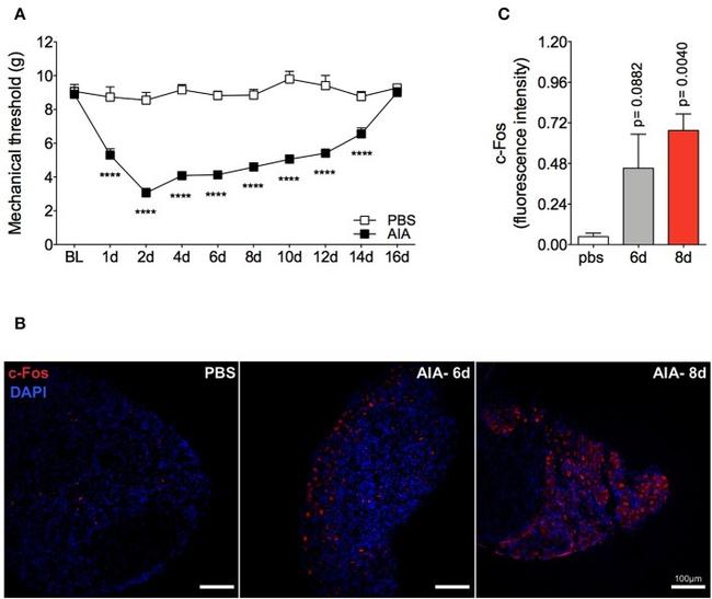 c-Fos Antibody in Immunohistochemistry (IHC)