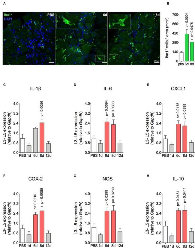 IBA1 Antibody in Immunohistochemistry (IHC)