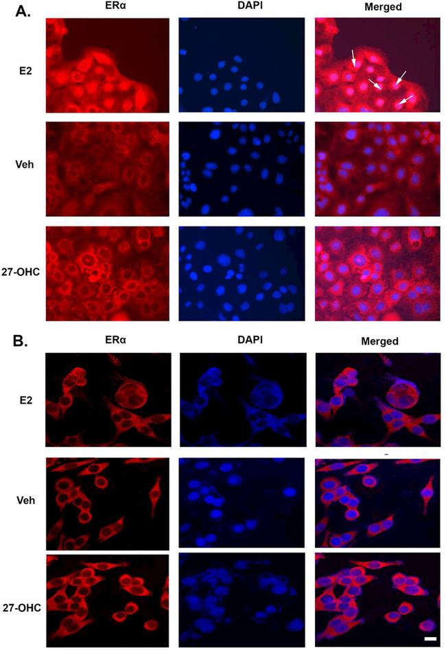 Estrogen Receptor alpha Antibody in Immunocytochemistry (ICC/IF)