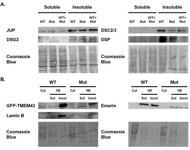 gamma Catenin Antibody in Western Blot (WB)