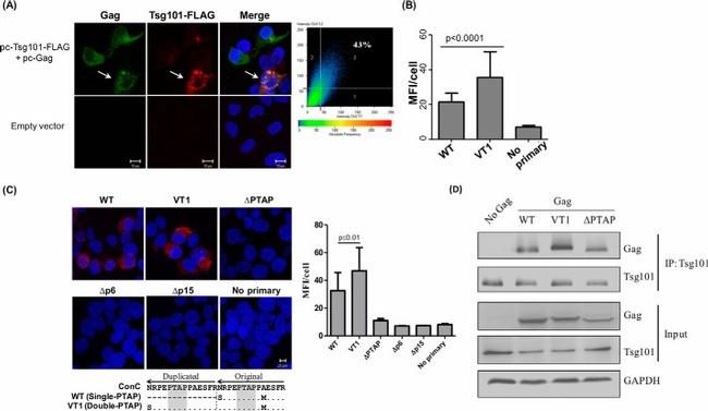 TSG101 Antibody in Western Blot, Immunoprecipitation (WB, IP)