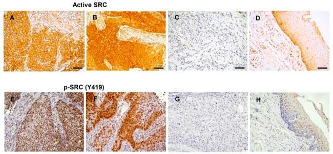 SRC (active) Antibody in Immunohistochemistry (IHC)