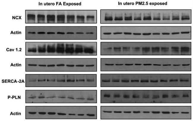 SERCA2 ATPase Antibody in Western Blot (WB)