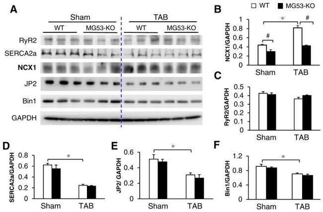 SERCA2 ATPase Antibody in Western Blot (WB)