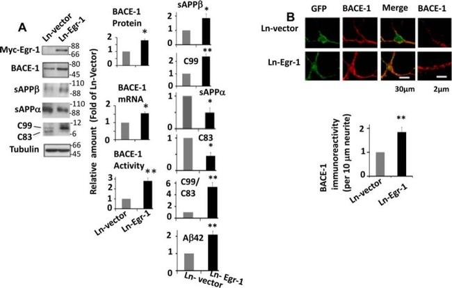 beta Amyloid Antibody in Western Blot (WB)