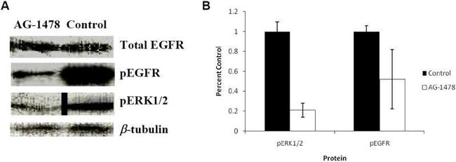 Phospho-EGFR (Tyr1086) Antibody in Western Blot (WB)