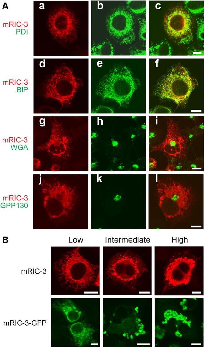 PDI Antibody in Immunocytochemistry (ICC/IF)