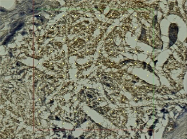 Calprotectin Antibody in Immunohistochemistry (IHC)