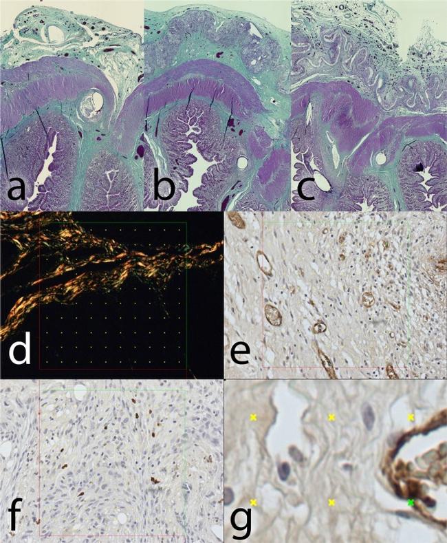 Calprotectin Antibody in Immunohistochemistry (IHC)