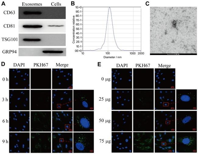 CD81 Antibody in Western Blot (WB)