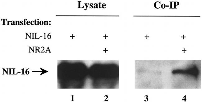 NMDAR2A Antibody in Immunoprecipitation (IP)