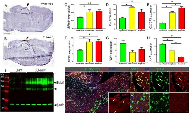 EphA4 Antibody in Immunohistochemistry (IHC)