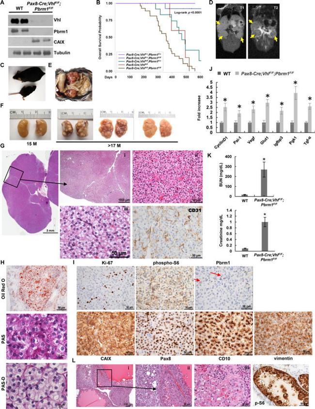 Carbonic Anhydrase IX Antibody in Immunohistochemistry (IHC)