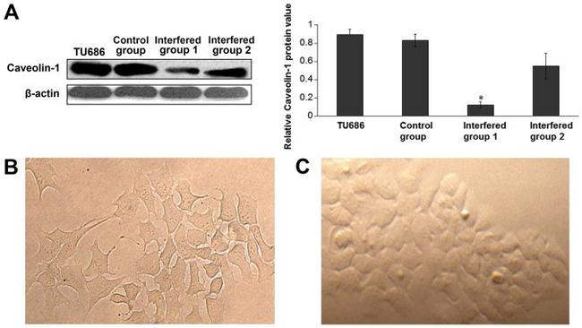 Caveolin 1 Antibody in Western Blot (WB)