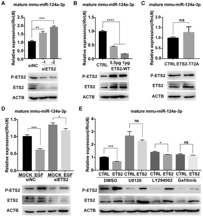 Phospho-ETS2 (Thr72) Antibody in Western Blot (WB)