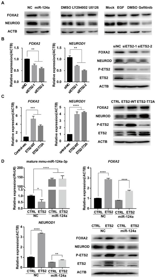 Phospho-ETS2 (Thr72) Antibody in Western Blot (WB)