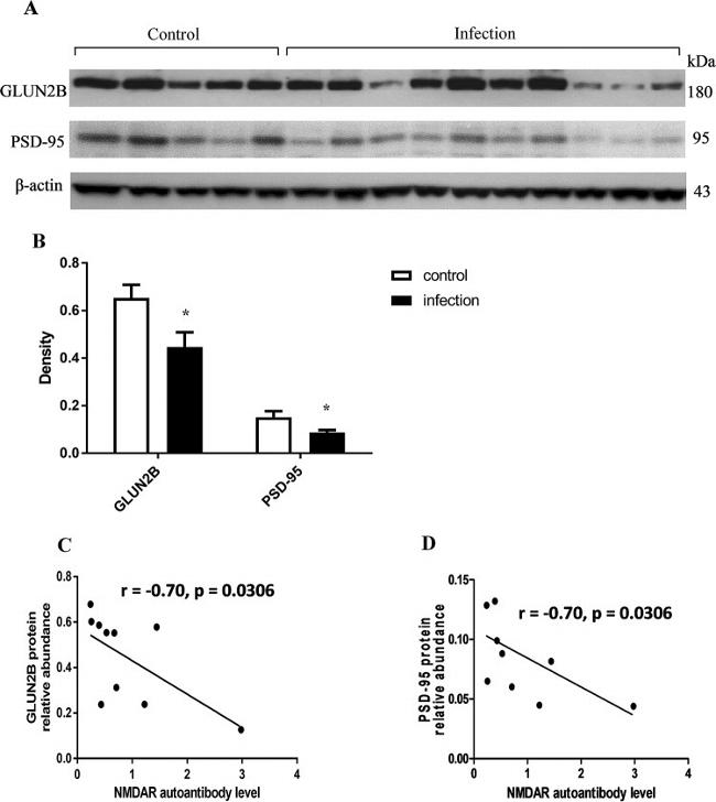 NMDAR2B Antibody in Western Blot (WB)