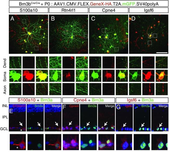 IGSF6 Antibody in Immunohistochemistry (IHC)