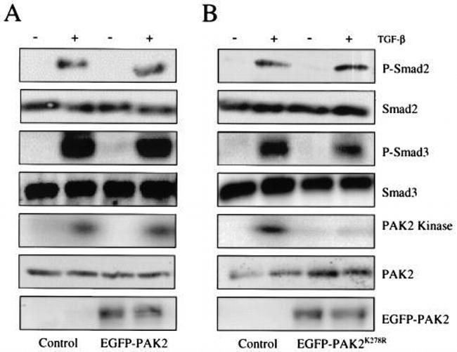 SMAD3 Antibody in Western Blot (WB)