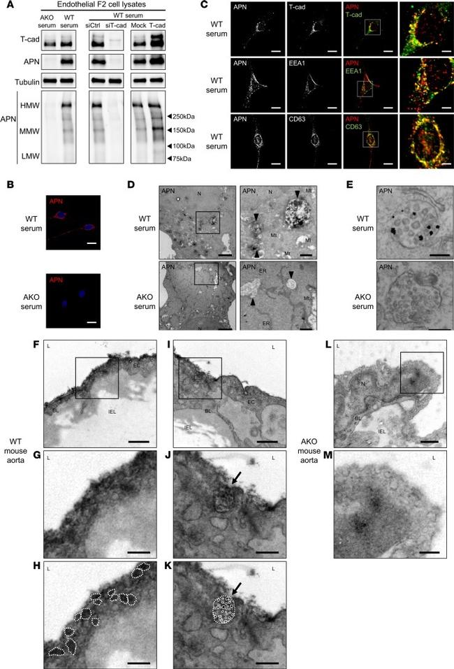 Adiponectin Antibody in Immunocytochemistry (ICC/IF)