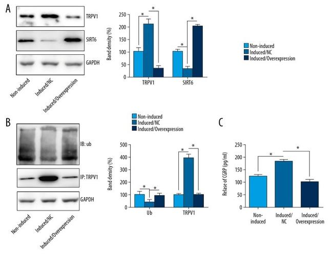 TRPV1 Antibody in Western Blot (WB)