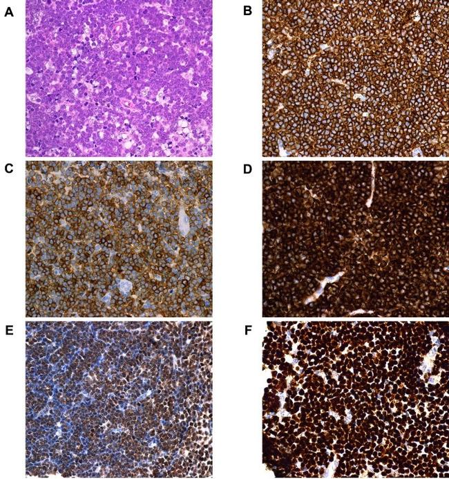 OLIG1 Antibody in Immunocytochemistry (ICC/IF)