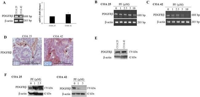 PDGFRB Antibody in Immunohistochemistry (IHC)