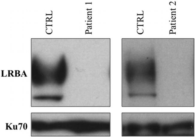 Ku70 Antibody in Western Blot (WB)