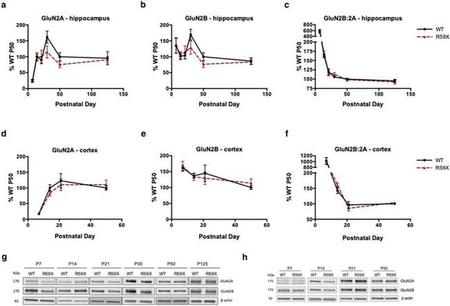 NMDAR2B Antibody in Western Blot (WB)