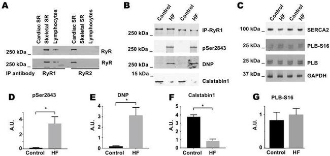 Phospholamban Antibody in Western Blot (WB)