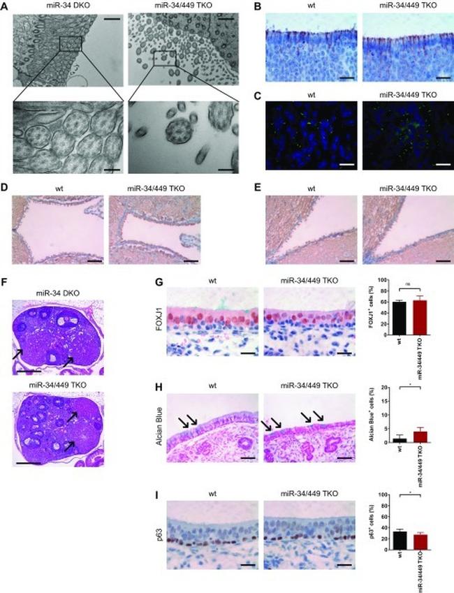 FOXJ1 Antibody in Immunohistochemistry (IHC)