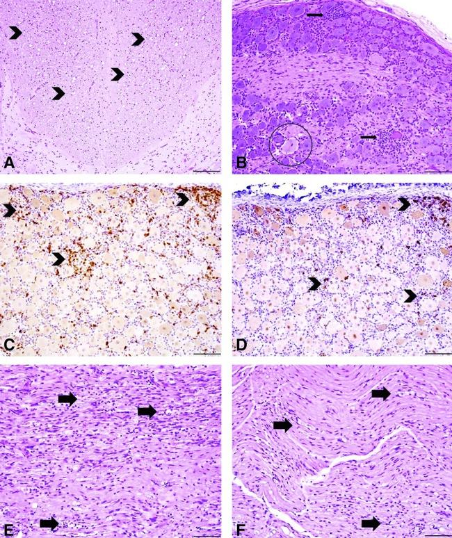 CD20 Antibody in Immunohistochemistry (IHC)