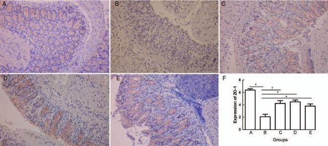 ZO-1 Antibody in Immunohistochemistry (IHC)