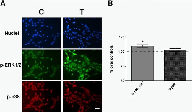 Phospho-ERK1/ERK2 (Thr185, Tyr187) Antibody in Immunocytochemistry (ICC/IF)