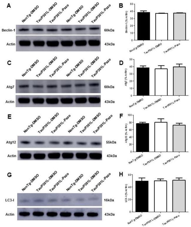 LC3A/LC3B Antibody in Western Blot (WB)