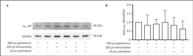 alpha-2a Adrenergic Receptor Antibody in Western Blot (WB)