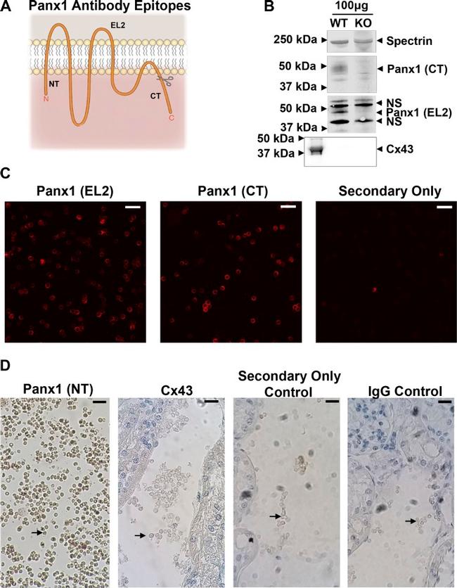 Pannexin 1 Antibody in Immunohistochemistry (IHC)