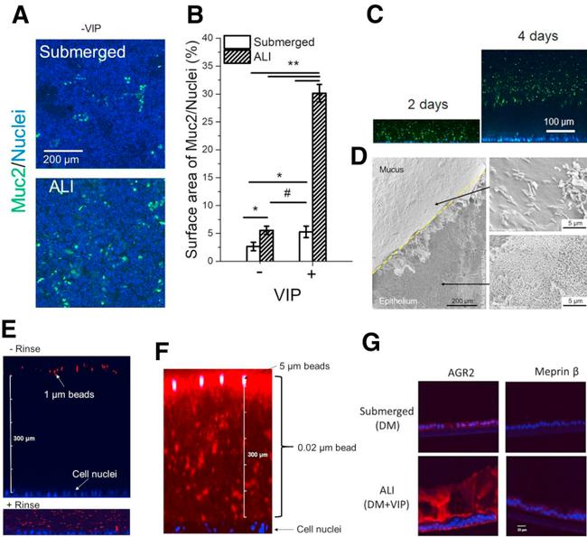 AGR2 Antibody in Immunohistochemistry (IHC)