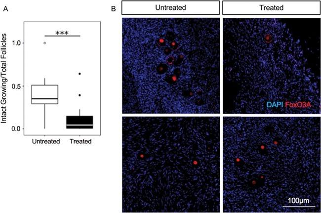 FOXO3A Antibody in Immunohistochemistry (IHC)