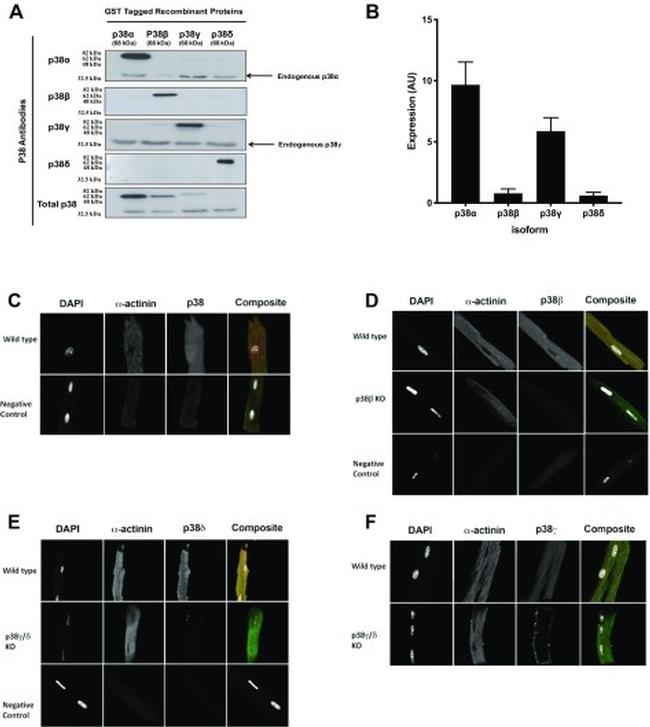 p38 MAPK alpha Antibody in Western Blot (WB)