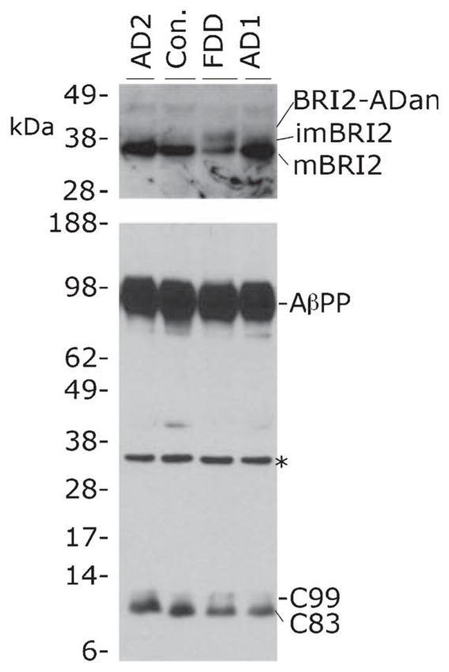 beta Amyloid Antibody in Western Blot (WB)