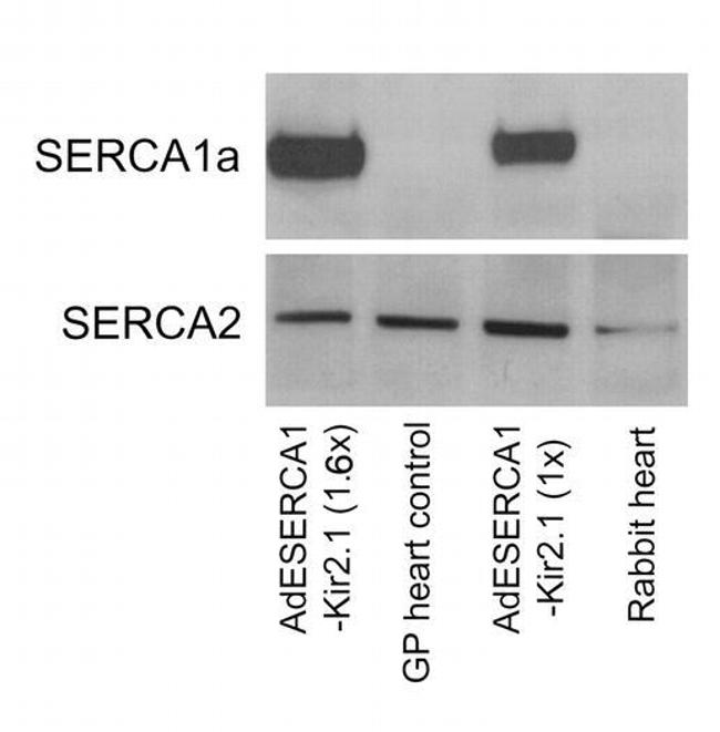 SERCA2 ATPase Antibody in Western Blot (WB)