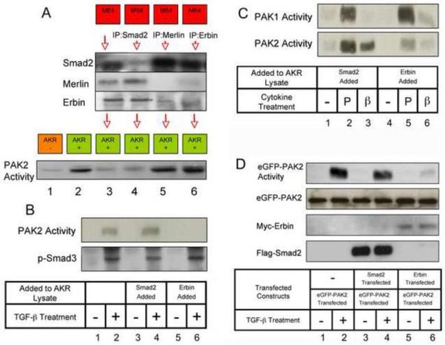 SMAD3 Antibody in Immunoprecipitation (IP)