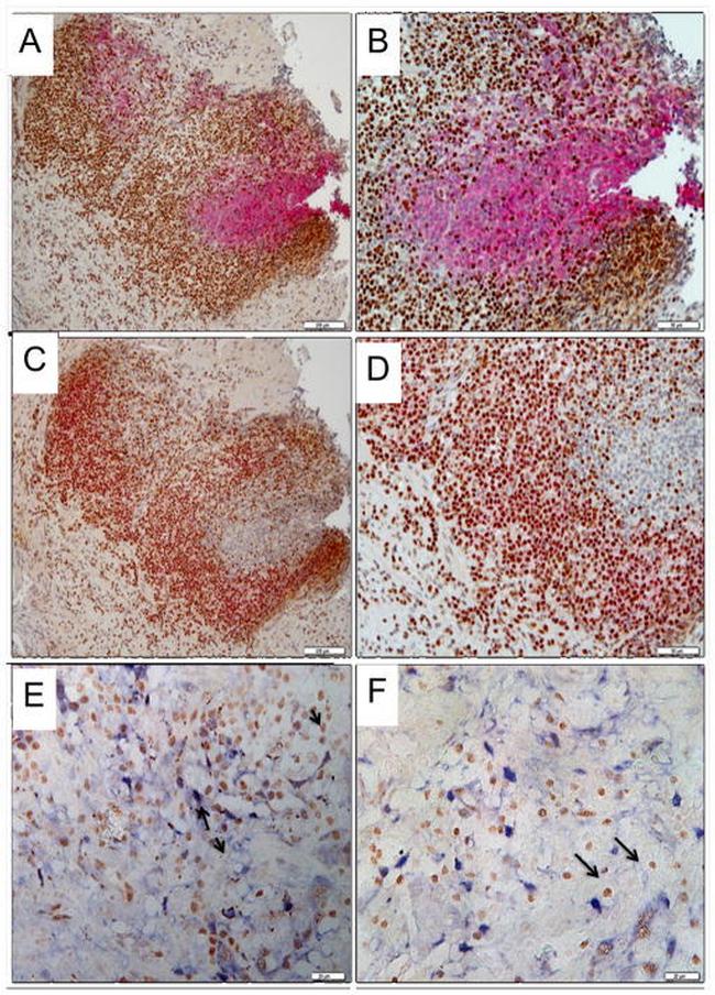 Galectin 3 Antibody in Immunohistochemistry (IHC)