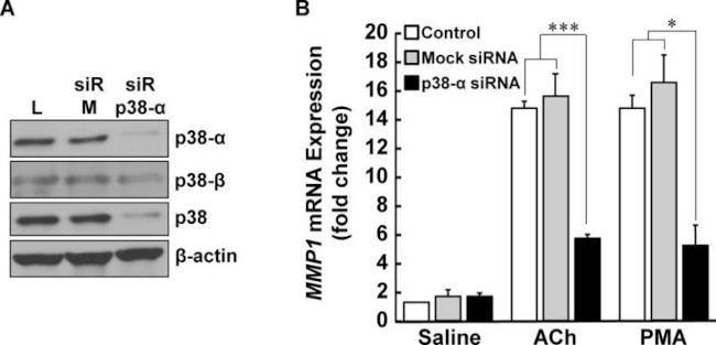 p38 MAPK alpha Antibody in Western Blot (WB)