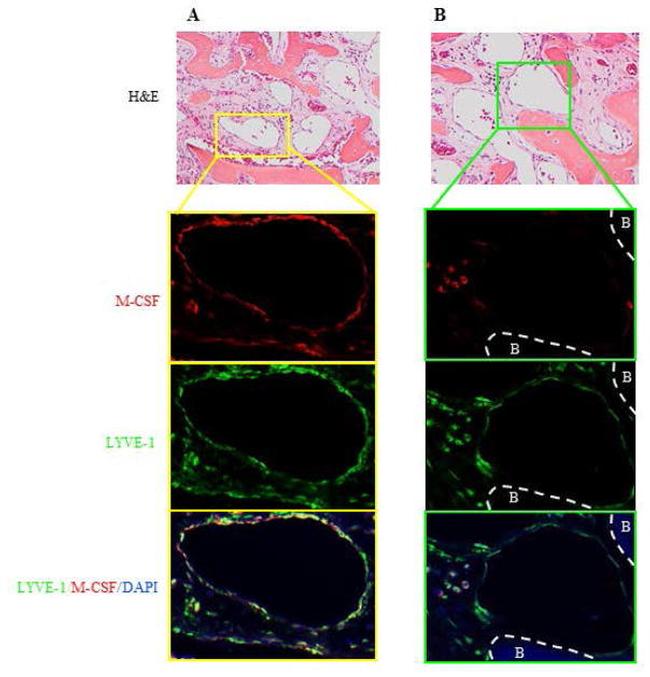 LYVE1 Antibody in Immunohistochemistry (IHC)